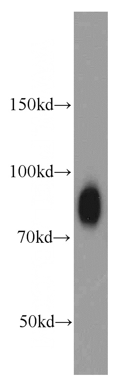 HeLa cells were subjected to SDS PAGE followed by western blot with Catalog No:109124(CD44 antibody) at dilution of 1:1000