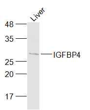 Fig3: Sample:; Liver (Mouse) Lysate at 40 ug; Primary: Anti-IGFBP4 at 1/1000 dilution; Secondary: IRDye800CW Goat Anti-Rabbit IgG at 1/20000 dilution; Predicted band size: 26 kDa; Observed band size: 27 kDa