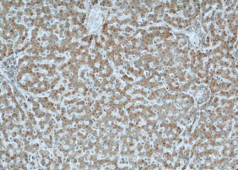 Immunohistochemical of paraffin-embedded human liver using Catalog No:109416(CMTM8 antibody) at dilution of 1:50 (under 10x lens)