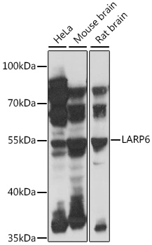 Western blot - LARP6 Polyclonal Antibody 