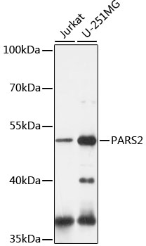Western blot - PARS2 Polyclonal Antibody 