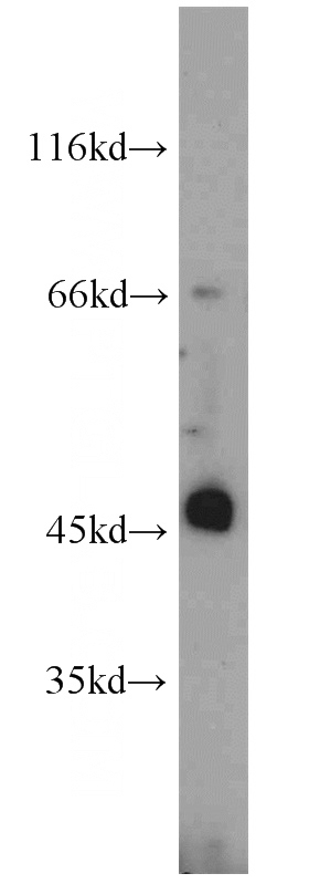 A549 cells were subjected to SDS PAGE followed by western blot with Catalog No:111799(INHBA antibody) at dilution of 1:1000