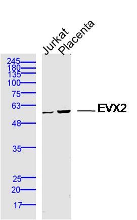 Fig1: Sample:; Jurkat Cell (Human) Lysate at 40 ug; Placenta (Mouse) Lysate at 40 ug; Primary: Anti-EVX2 at 1/300 dilution; Secondary: IRDye800CW Goat Anti-Rabbit IgG at 1/20000 dilution; Predicted band size: 48 kD; Observed band size: 52 kD