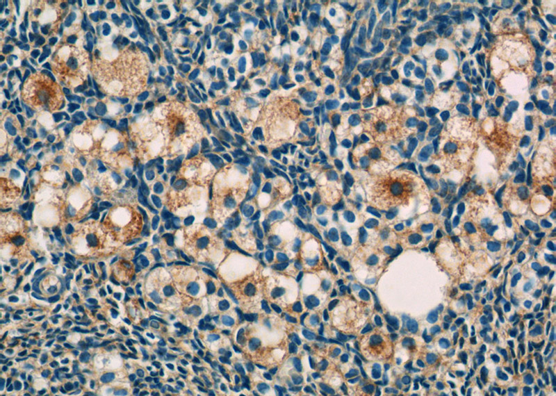Immunohistochemistry of paraffin-embedded human ovary tissue slide using Catalog No:114553(RAPH1 Antibody) at dilution of 1:50 (under 40x lens)