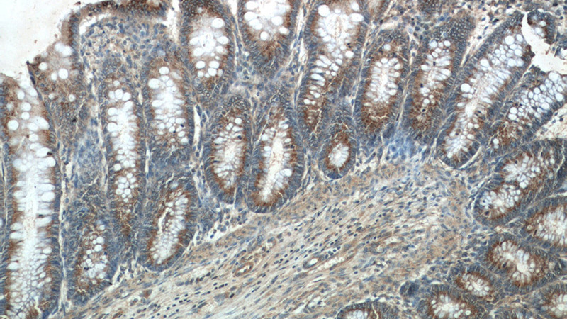 Immunohistochemistry of paraffin-embedded human colon tissue slide using Catalog No:115030(SDF4 Antibody) at dilution of 1:50 (under 10x lens)