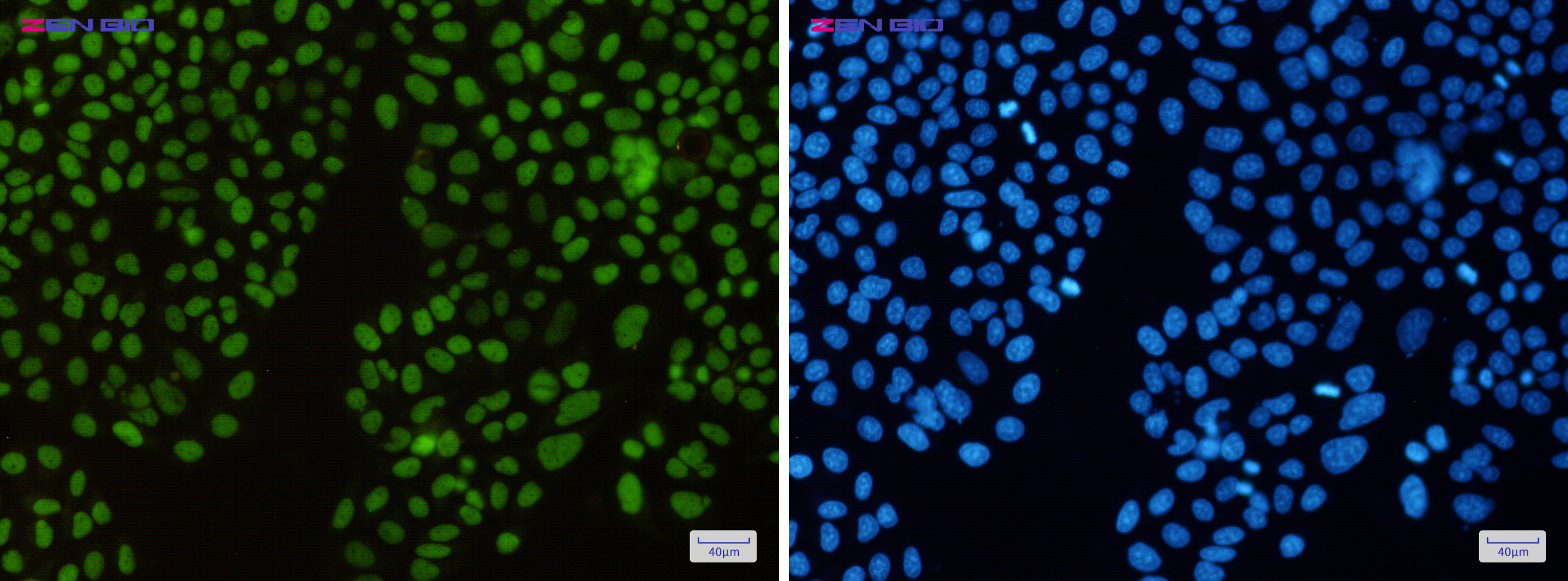 Immunocytochemistry of KAT1(green) in Hela cells using KAT1 Rabbit pAb at dilution 1/50, and DAPI(blue)