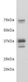 Fig1:; Western blot analysis of CD24 on mouse brain tissue lysates. Proteins were transferred to a PVDF membrane and blocked with 5% BSA in PBS for 1 hour at room temperature. The primary antibody ( 1/500) was used in 5% BSA at room temperature for 2 hours. Goat Anti-Rabbit IgG - HRP Secondary Antibody (HA1001) at 1:200,000 dilution was used for 1 hour at room temperature.
