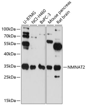Western blot - NMNAT2 Polyclonal Antibody 