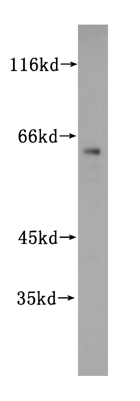 Jurkat cells were subjected to SDS PAGE followed by western blot with Catalog No:116954(ZNF18 antibody) at dilution of 1:300