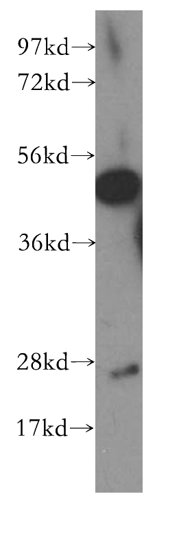 human brain tissue were subjected to SDS PAGE followed by western blot with Catalog No:109361(CNTFR antibody) at dilution of 1:500