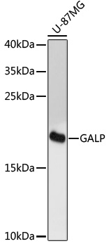 Western blot - GALP Polyclonal Antibody 