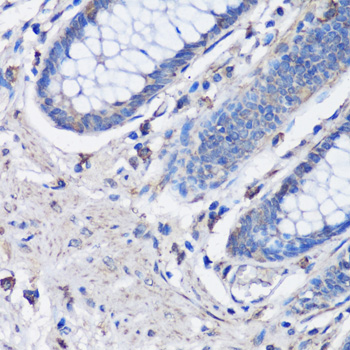 Immunohistochemistry - NLRC4 Polyclonal Antibody 