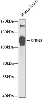 Western blot - STRN3 Polyclonal Antibody 