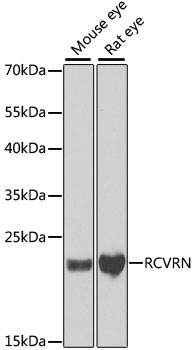 Western blot - RCVRN Polyclonal Antibody 