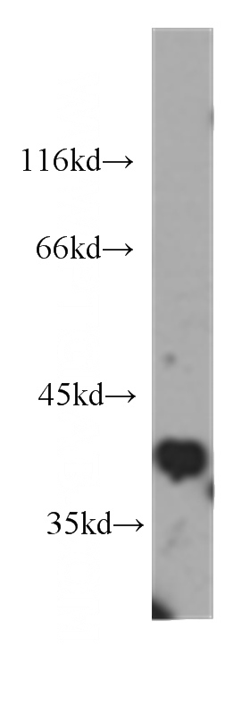 HepG2 cells were subjected to SDS PAGE followed by western blot with Catalog No:107075(B23 antibody) at dilution of 1:1000