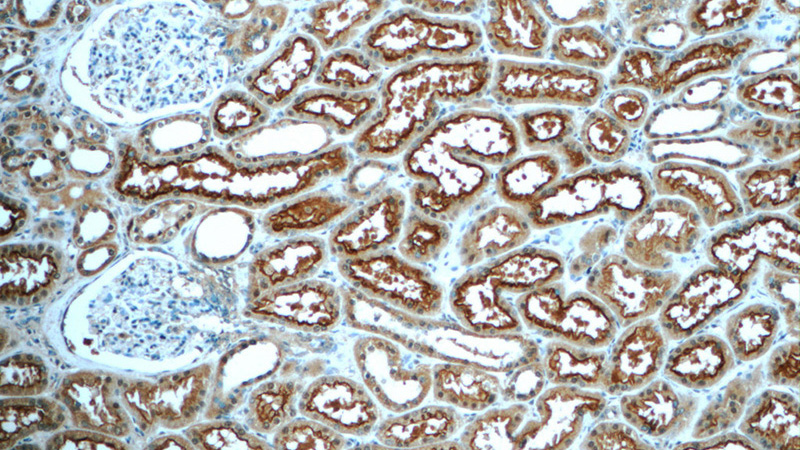 Immunohistochemistry of paraffin-embedded human kidney tissue slide using Catalog No:113320(SLC22A5 Antibody) at dilution of 1:50 (under 10x lens)