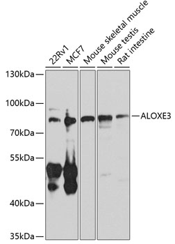 Western blot - ALOXE3 Polyclonal Antibody 