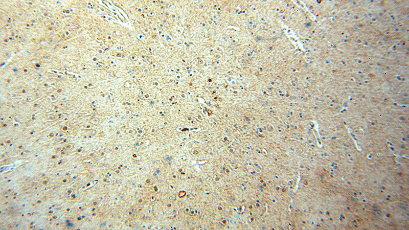Immunohistochemical of paraffin-embedded human brain using Catalog No:115009(SCNM1 antibody) at dilution of 1:50 (under 10x lens)