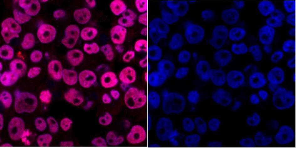 Fig3: ICC staining DPY30 in NCCIT cells (red). Cells were fixed in paraformaldehyde, permeabilised with 0.25% Triton X100/PBS and counterstained with DAPI in order to highlight the nucleus (blue).