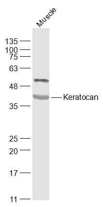 Fig1: Sample:; Muscle (Mouse) Lysate at 40 ug; Primary: Anti-Keratocan at 1/1000 dilution; Secondary: IRDye800CW Goat Anti-Rabbit IgG at 1/20000 dilution; Predicted band size: 38 kD; Observed band size: 38 kD