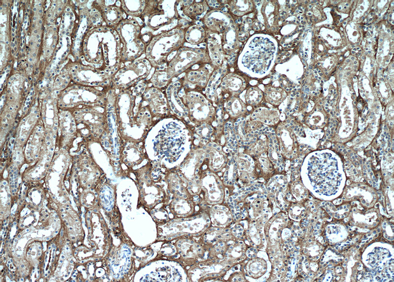 Immunohistochemical of paraffin-embedded human kidney using Catalog No:110656(FGB antibody) at dilution of 1:50 (under 10x lens)