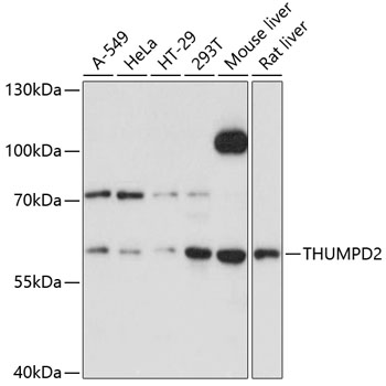 Western blot - THUMPD2 Polyclonal Antibody 
