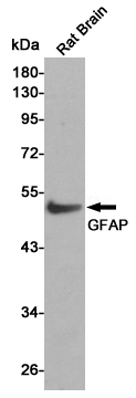 Western blot analysis of GFAP expression in Rat Brain cell lysates using GFAP antibody at 1/1000 dilution.Predicted band size:50KDa.Observed band size:50KDa.