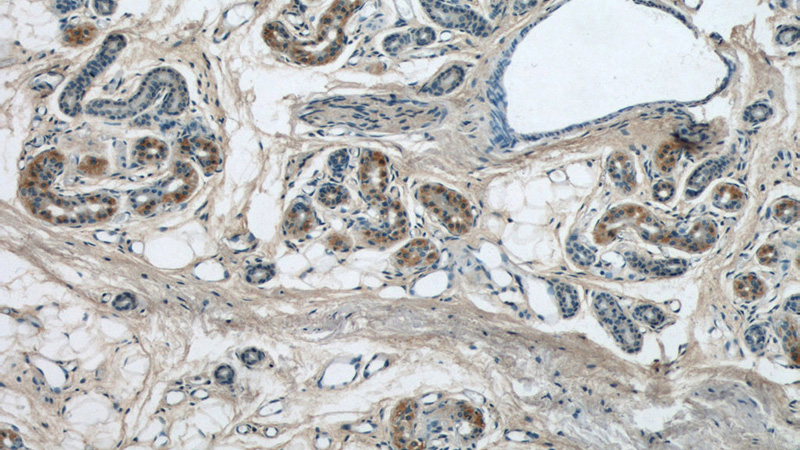 Immunohistochemical of paraffin-embedded human skin using Catalog No:111996(KIAA1602 antibody) at dilution of 1:50 (under 10x lens)