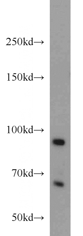 Y79 cells were subjected to SDS PAGE followed by western blot with Catalog No:114228(PRPF3 antibody) at dilution of 1:1000