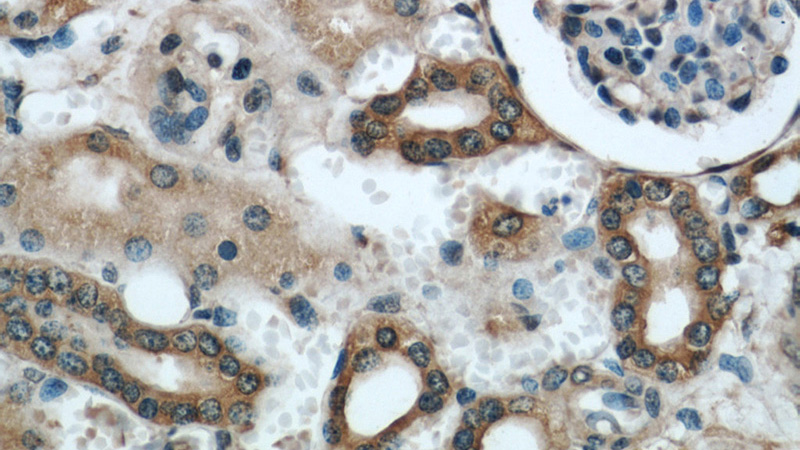 Immunohistochemical of paraffin-embedded human kidney using Catalog No:113598(PARVA antibody) at dilution of 1:50 (under 40x lens)