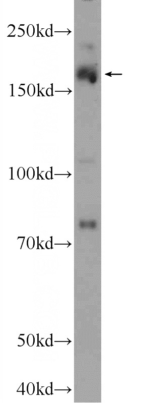 MCF-7 cells were subjected to SDS PAGE followed by western blot with Catalog No:114173(PRDM15 Antibody) at dilution of 1:300