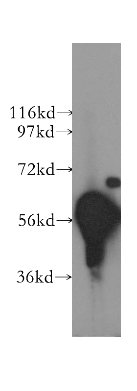mouse testis tissue were subjected to SDS PAGE followed by western blot with Catalog No:110144(DYRK1B antibody) at dilution of 1:500