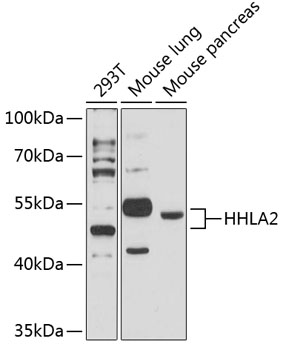 Western blot - HHLA2 Polyclonal Antibody 