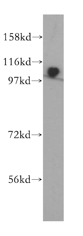 HeLa cells were subjected to SDS PAGE followed by western blot with Catalog No:117052(ZHX1 antibody) at dilution of 1:500