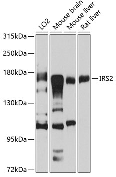 Western blot - IRS2 Polyclonal Antibody 