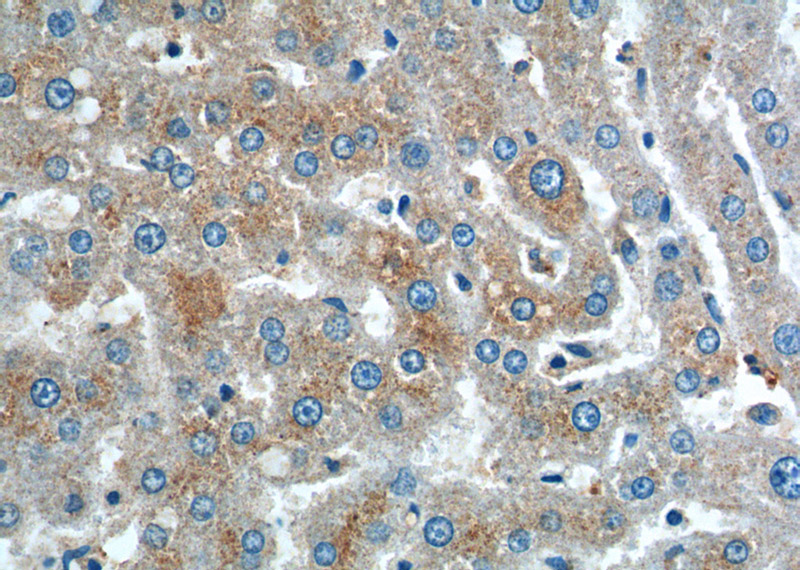 Immunohistochemistry of paraffin-embedded human liver tissue slide using Catalog No:111676(IGF1A-Specific Antibody) at dilution of 1:200 (under 40x lens).