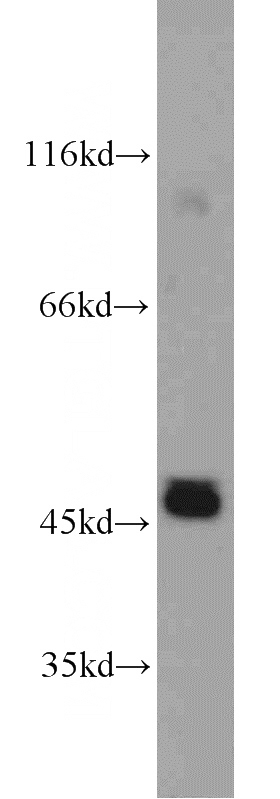 mouse brain tissue were subjected to SDS PAGE followed by western blot with Catalog No:111169(GSK3B antibody) at dilution of 1:1000