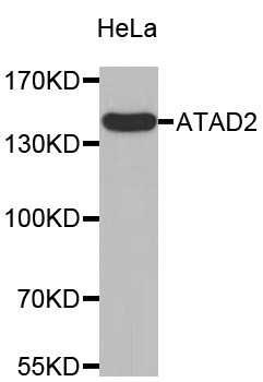 Western blot - ATAD2 Polyclonal Antibody 