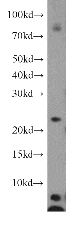 Jurkat cells were subjected to SDS PAGE followed by western blot with Catalog No:108255(ARFRP1 antibody) at dilution of 1:800