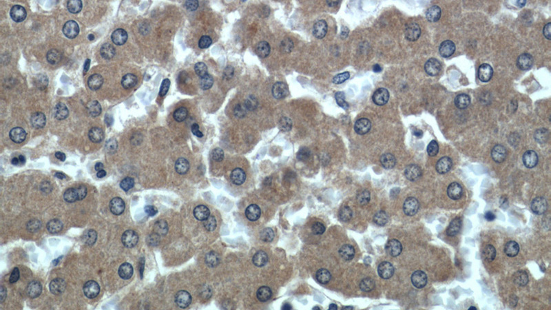 Immunohistochemical of paraffin-embedded human liver using Catalog No:108534(BST2 antibody) at dilution of 1:50 (under 40x lens)