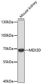 Western blot - MEX3D Polyclonal Antibody 