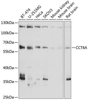Western blot - CCT6A Polyclonal Antibody 