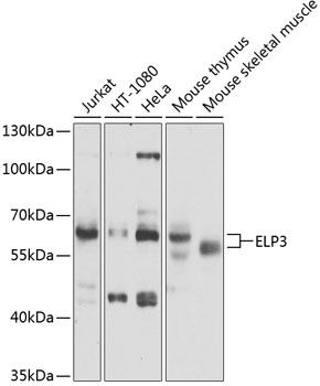 Western blot - ELP3 Polyclonal Antibody 