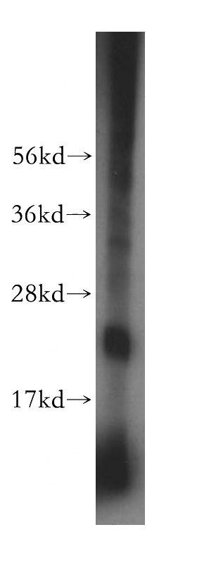 mouse uterus tissue were subjected to SDS PAGE followed by western blot with Catalog No:114303(PSG11 antibody) at dilution of 1:600