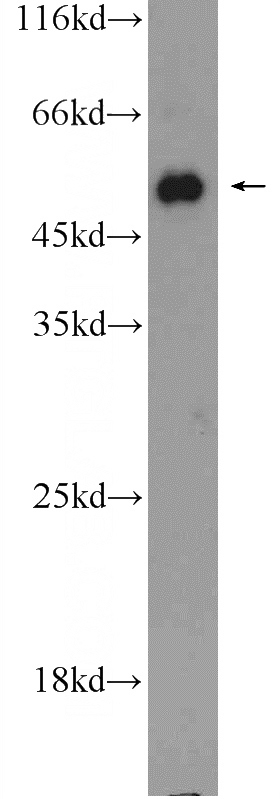 HEK-293 cells were subjected to SDS PAGE followed by western blot with Catalog No:107753(ACVR1B Antibody) at dilution of 1:300