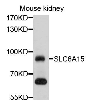 Western blot - SLC6A15 Polyclonal Antibody 