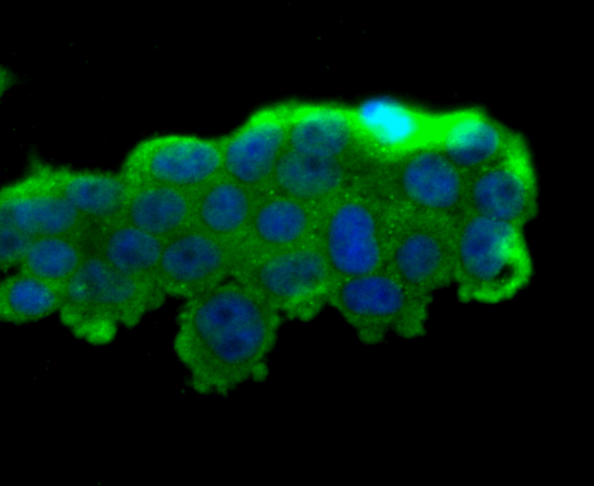 Fig3: ICC staining PRTN3 in 293T cells (green). The nuclear counter stain is DAPI (blue). Cells were fixed in paraformaldehyde, permeabilised with 0.25% Triton X100/PBS.