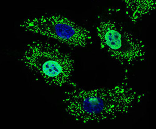 Fig4: ICC staining WHSC2 (green) in HeLa cells. The nuclear counter stain is DAPI (blue). Cells were fixed in paraformaldehyde, permeabilised with 0.25% Triton X100/PBS.