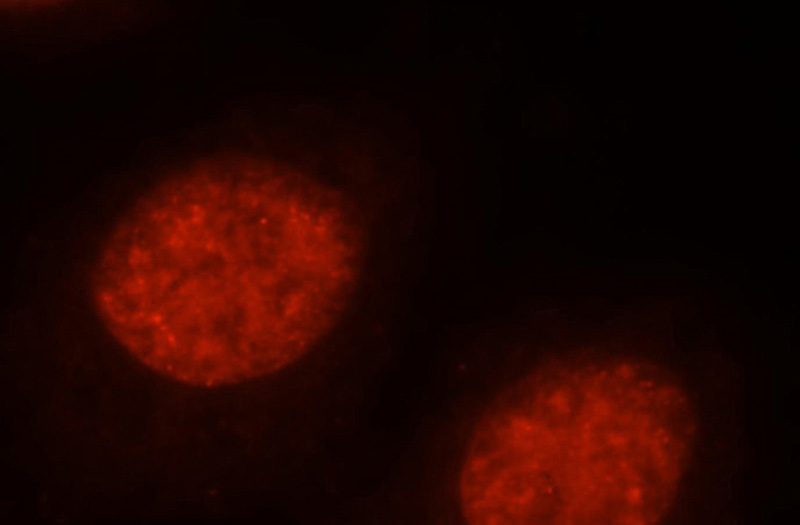 Immunofluorescent analysis of Hela cells, using MSH2 antibody Catalog No:112867 at 1:25 dilution and Rhodamine-labeled goat anti-rabbit IgG (red).