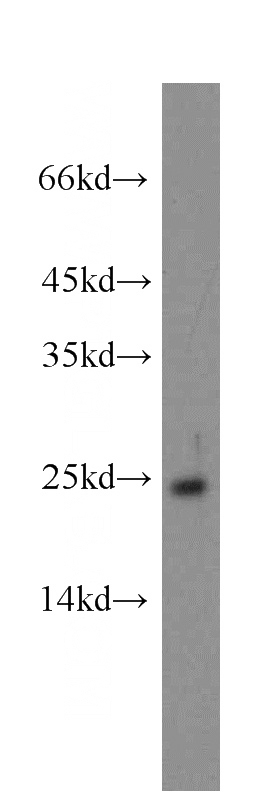 Y79 cells were subjected to SDS PAGE followed by western blot with Catalog No:110897(GUCA1A antibody) at dilution of 1:200